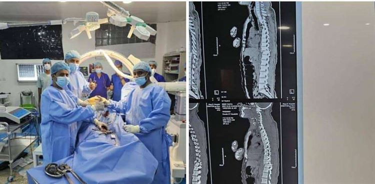 لأول مرة في هيئة مستشفى شبوة العام.. إجراء عملية نوعية في العمود الفقري