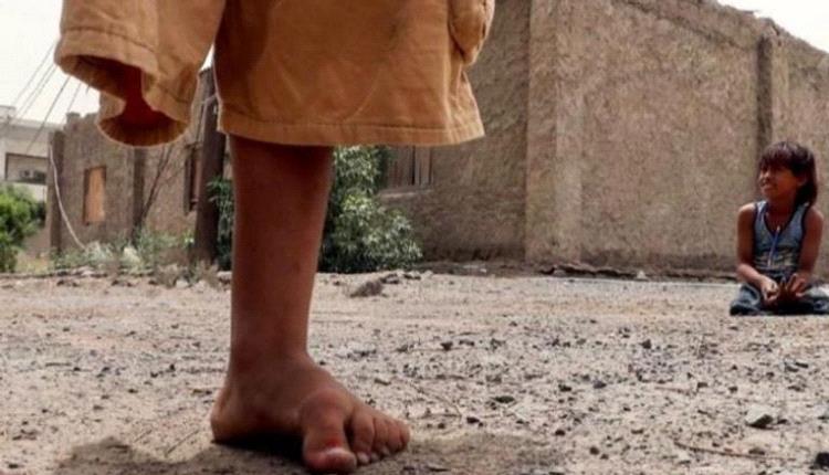 وفاة طفلة وإصابة طفل بانفجار لغمين حوثييّن في حجة والحديدة
