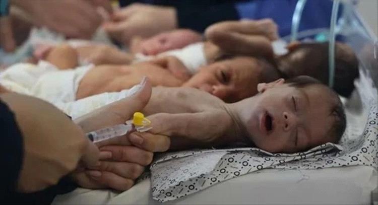 صحة غزة: 500 رضيع في مستشفيات غزة بسبب الجوع وسوء التغذية