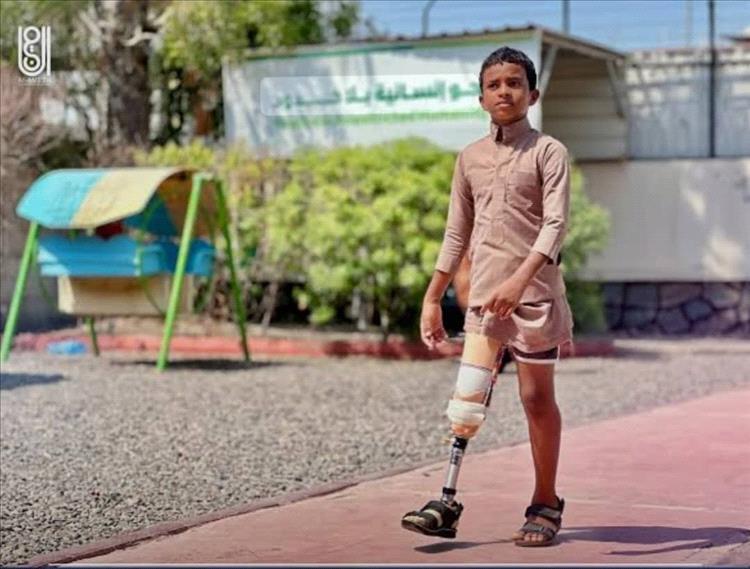 مركز الأطراف الصناعية بعدن يقدّم خدماته لـ595 مستفيداً خلال يوليو 2025م