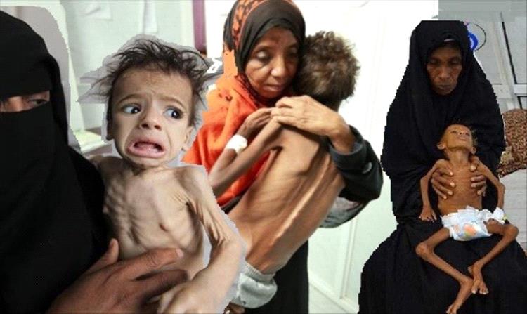 عبس في قبضة الجوع.. أكثر من 41 ألف شخص مهددون بالمجاعة في حجة