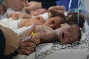 صحة غزة: 500 رضيع في مستشفيات غزة بسبب الجوع وسوء التغذية