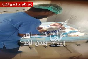 مستشفى أحور العام يواصل إجراء العمليات القيصرية