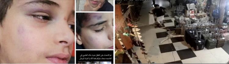"اعتداء صادم لطفل في قلب صنعاء.. وحشية حوثية تثير غضب اليمنيين"