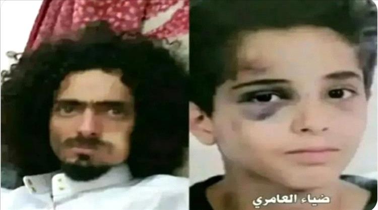 طفل يتعرض لاعتداء وحشي في صنعاء.. تفاصيل القصة الكاملة