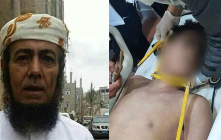 ضرب وخنق من قارئ رقية شرعية يودي بحياة فتى في إب