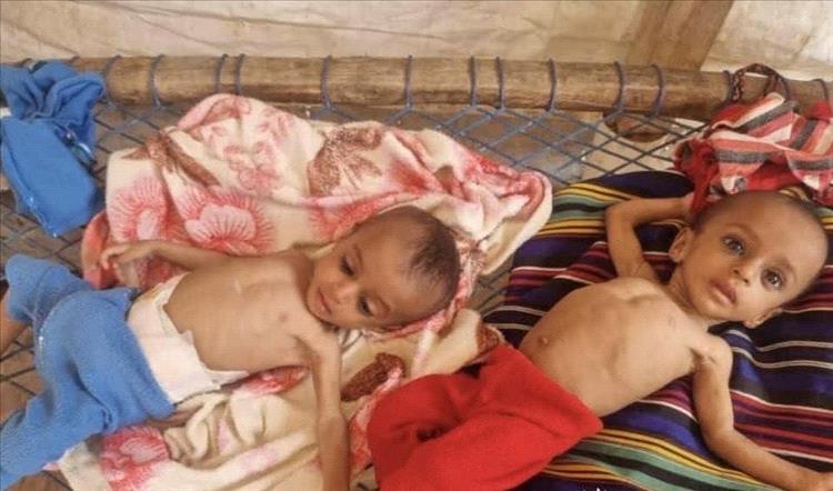 ظهور بؤرة للمجاعة في مناطق سيطرة الحوثيين
