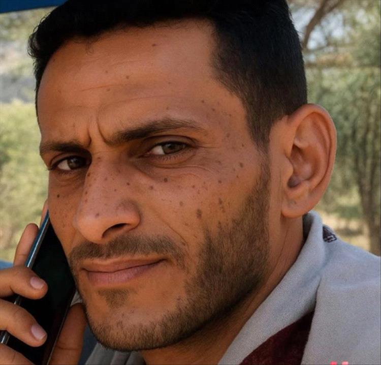 صنعاء.. العثور على جثة شخص مدفونًا في منطقة الروضة قرب الكلية الحربية
