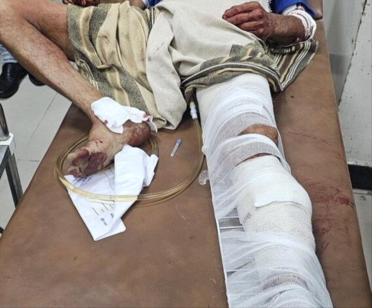 للمرة الثالثة.. إصابة مواطن بقناص حوثي أمام منزله بتعز