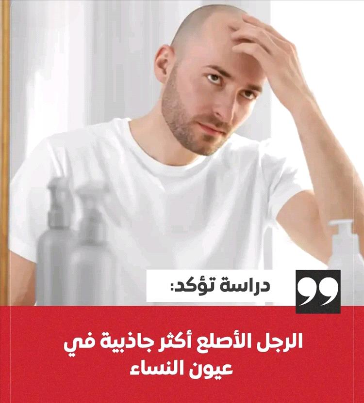 دراسة تقلب الموازين: الرجل الأصلع في صدارة الجاذبية