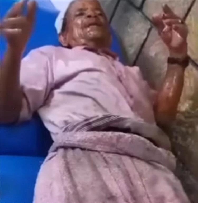القبض على متهم بالاعتداء على مسن وحرقه بالزيت في إب