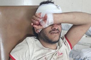 تعز.. إصابة شاب بجروح بالغة برصاص قناص حوثي