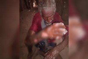 وفاة طفلة وإصابة أفراد من أسرتها جراء حريق التهم مسكنهم في الحديدة