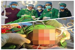 إصابة شاب في رأسه إثر سقوط حجر أثناء حفر بئر في بيحان بشبوة