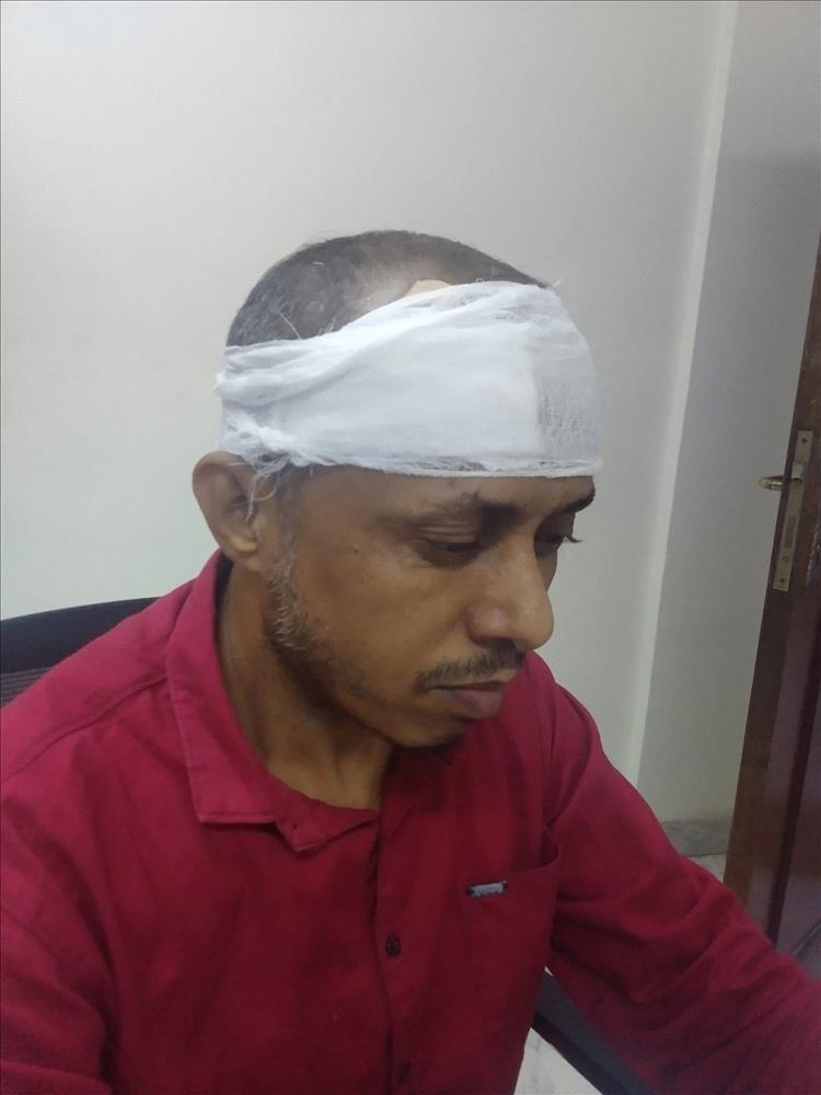 مجهول يعتدي على الصحفي صالح أبو عوذل في عدن