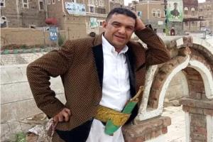 وفاة الفنان اليمني علي عنبة في القاهرة بعد 18 يومًا من مغادرته صنعاء.. ورحيله يفضح قسوة جماعة الحوثي ضد الفنانين
