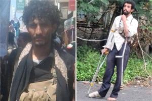 مجلس المقاومة الشعبية بتعز: استشهاد مقاتلَين مُعاقَين في جبهة كلابة "رسالة صمود وعزّة "