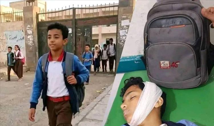 وكيل أول محافظة تعز يعزي باستشهاد الطفل إبراهيم جلال