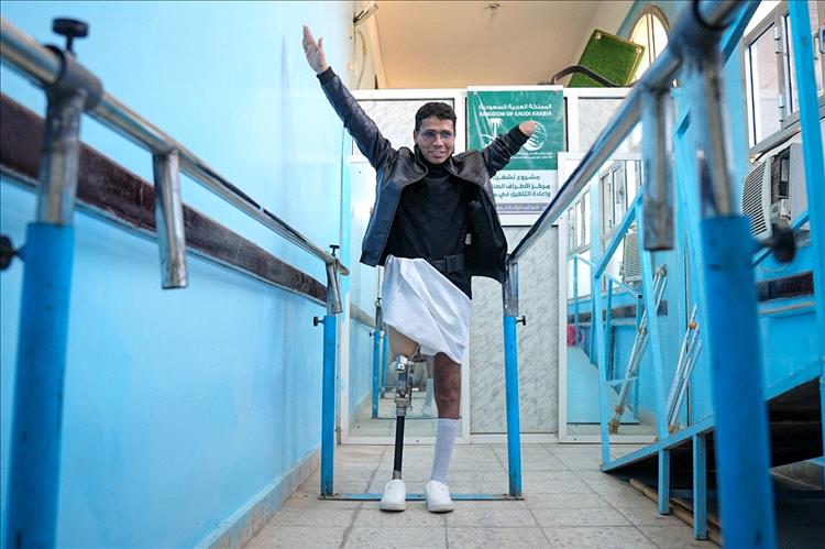 بمرحلته الحادية عشرة .. مركز الأطراف الصناعية بمأرب 576 مستفيد خلال مارس المنصرم