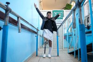 بمرحلته الحادية عشرة مركز الأطراف الصناعية بمأرب ٥٧٦ مستفيد خلال مارس المنصرم