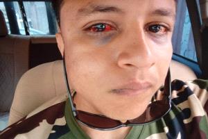 محامية تدعو إلى فتح تحقيق جاد وشفاف عقب الاعتداء على مواطن في قسم شرطة بعدن