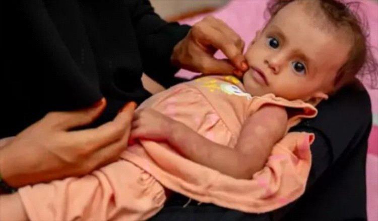 الصحة العالمية: اليمن يقترب من انهيار صحي شامل وسط أزمات متفاقمة