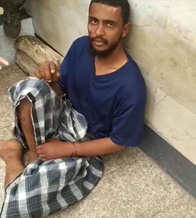 ظهور شاب في العاصمة المؤقتة عدن بعد خروجه من سجن سري وآثار تعذيب مروعة تثير صدمة واسعة