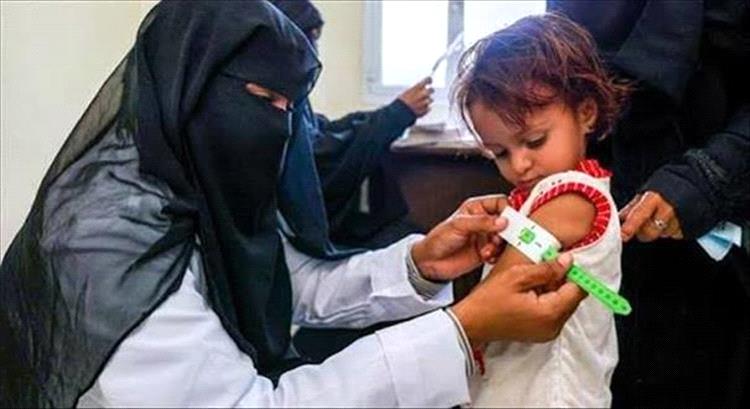 تقرير أممي صادم: ثلثا أطفال اليمن الرضّع يعانون من فقر غذائي حاد
