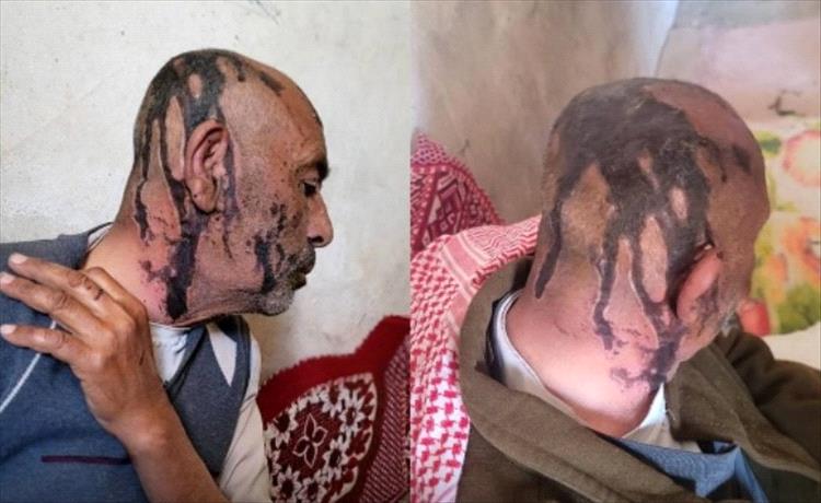 اعتداء وحشي على مُسن في عمران