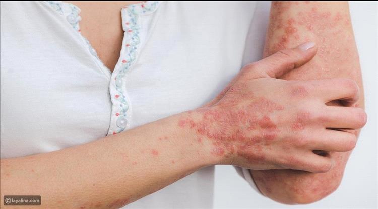 التهاب الدم: الأعراض، المراحل، والتحذيرات الطبية