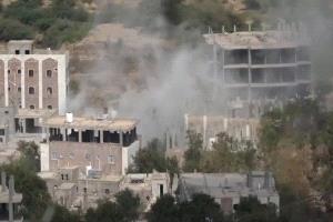 مُنع من إسعافه إلى المستشفى.. إصابة طفل برصاص حو_ثي في قرية بعمران