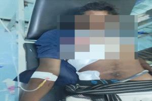 إصابة مدني بقصف حو_ثي استهدف مخيمًا للنازحين جنوب الحديدة