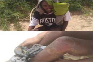 تنامي شكاوى حول انتهاكات وعمليات ابتزاز يتعرض لها مهاجرون أفارقة في مديرية أحور