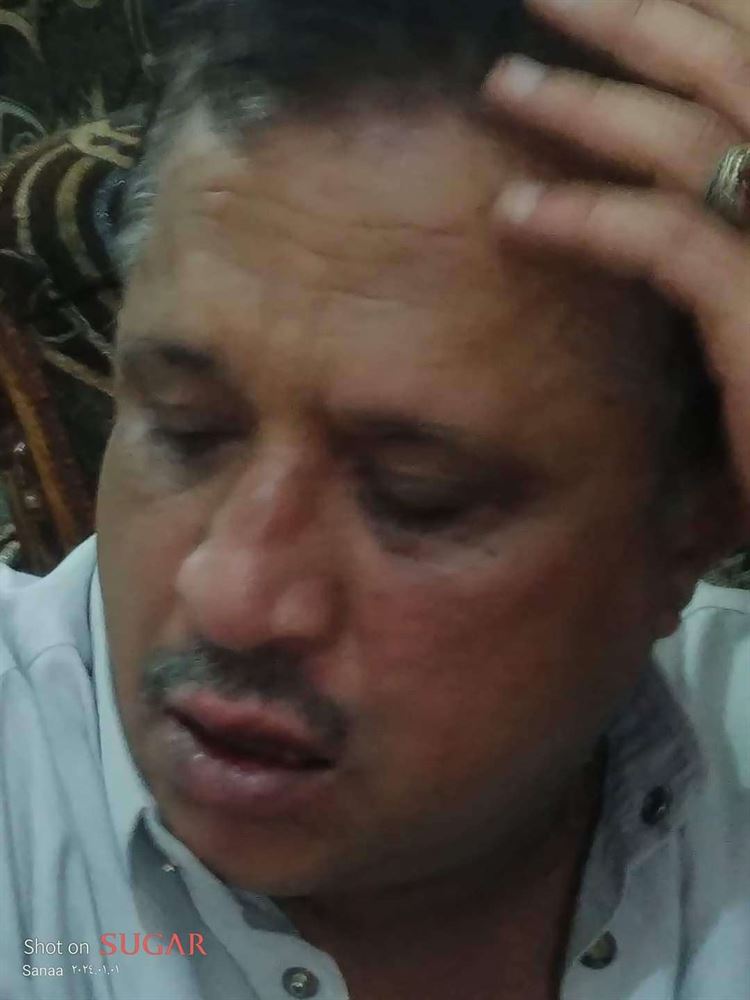 للمره الثانية ..تعرض الصحفي مجلي الصمدي للإعتداء بصنعاء