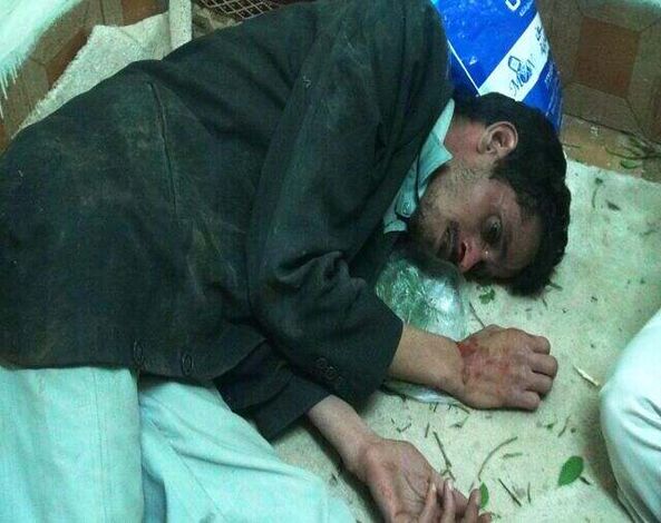 حزبيون بساحة التغيير يعتدون بالضرب على صحفي ويكسرون رقبته .