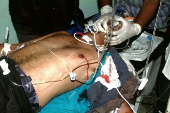 حدث قبل قليل: شهيدان في مواصلة الجيش اليمني قصف المدنيين في الضالع