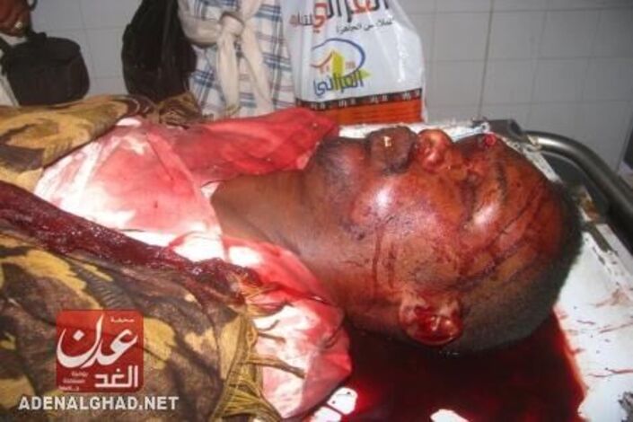 حدث قبل قليل: مقتل شاب بحوطة لحج برصاص مسلحين مجهولين (مصور)