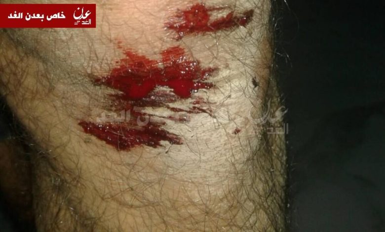 مجهولون يعتدون بالضرب الوحشي على صحفي بعدن
