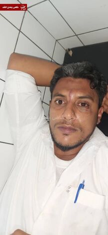 بالصور:  مرافقون لقيادي كبير في الحزام يعتدون بالضرب المبرح على ضابط بأمن مطار عدن طلب منهم الالتزام بالنظم والقوانين