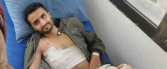 في واقعة تاريخية نادرة.. جرحى اثر مشهد تمثيلي لمسلسل حوثي تضمن تفجيراً بصنعاء