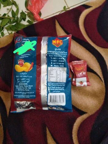 شكاوى من أنواع رديئة لبطاطس الأطفال